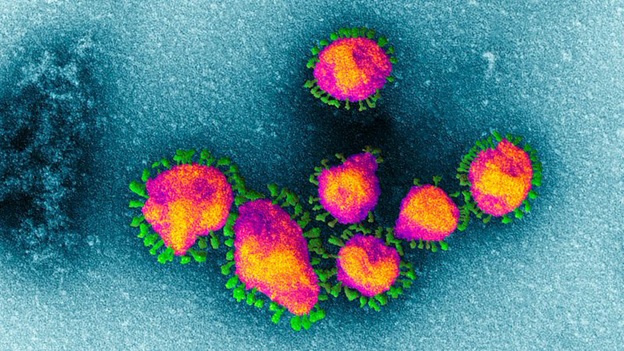 Virus Covid-19 đang khiến con người phải lao đao