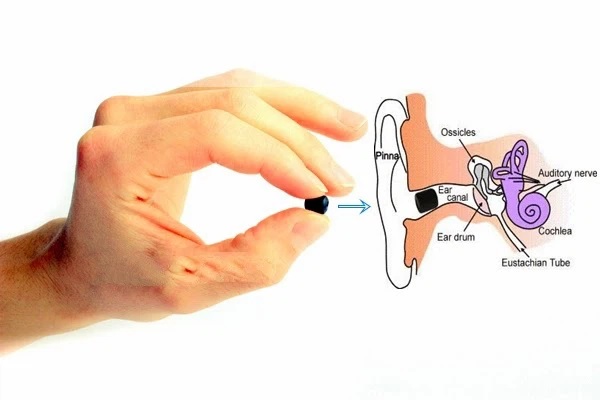 Tai nghe siêu nhỏ có thể nhét vào sâu trong tai