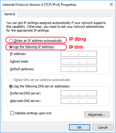Tùy chọn sét IP động và IP tĩnh