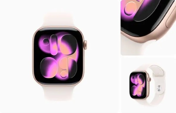 Apple Watch Series 11 Màu Vàng Hồng