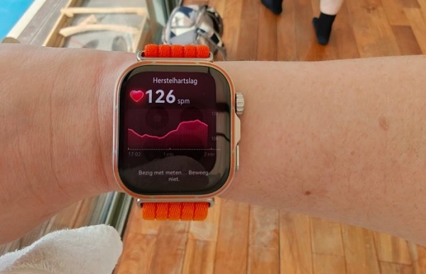 Tích hợp điện tâm đồ ECG và tầm soát nguy cơ tiểu đường