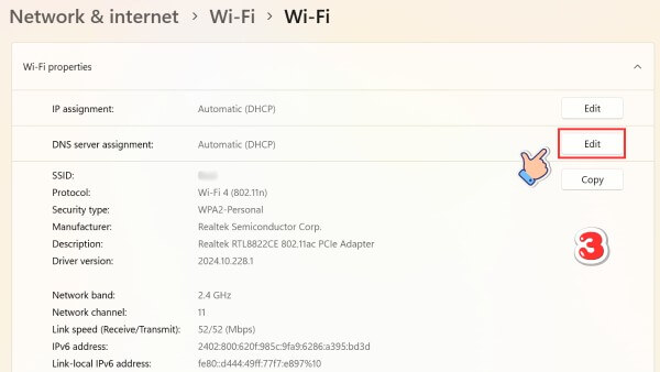 Chỉnh sửa DNS server assignment