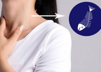 Mẹo chữa hóc xương cá tại nhà an toàn, dễ thực hiện