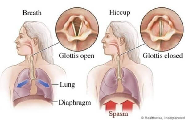 Tìm hiểu về cơ chế khi bị nấc cụt