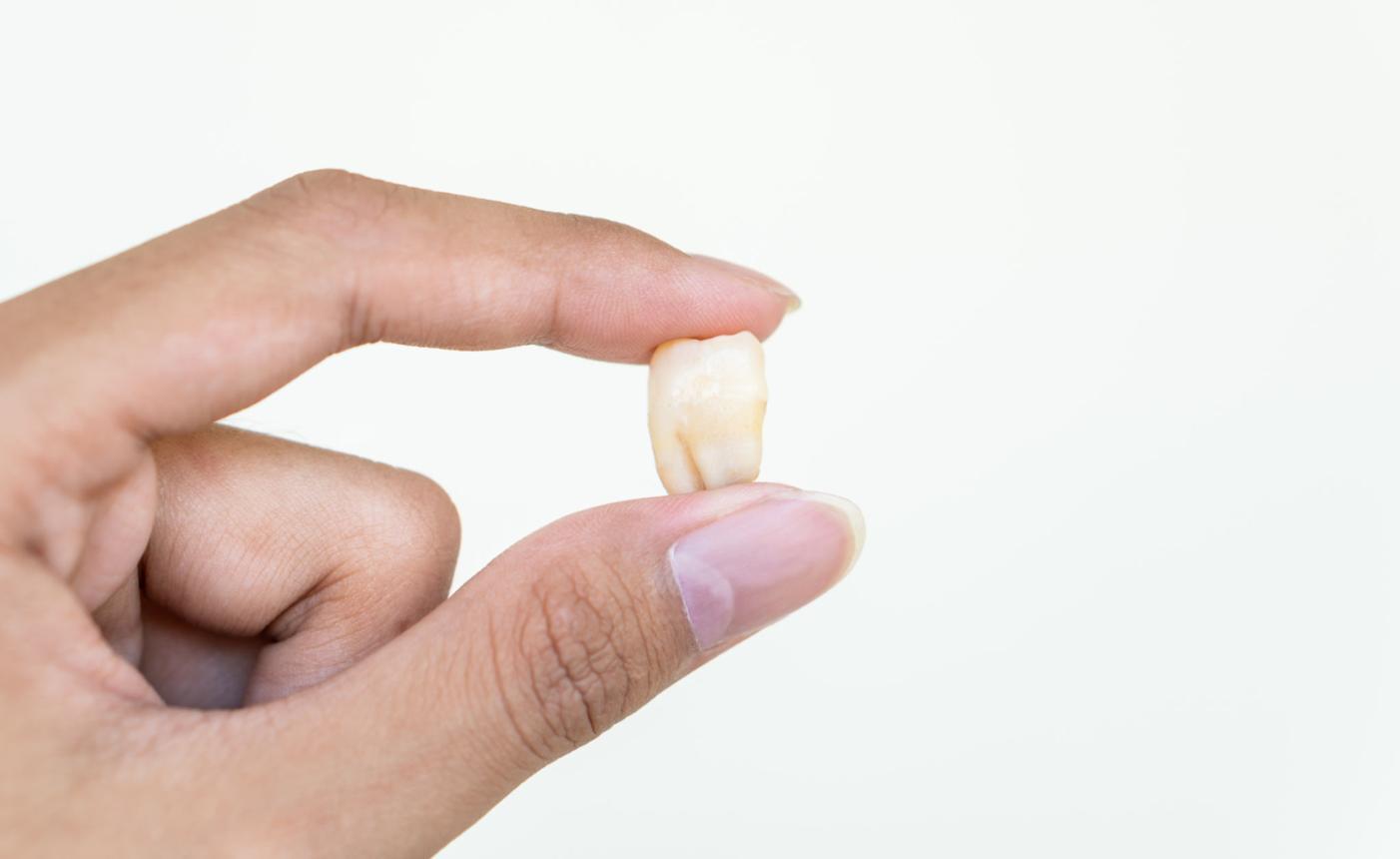 Giấc mơ rụng răng không chảy máu thường được liên hệ với sự thay đổi, những lựa chọn mới và việc khép lại giai đoạn cũ