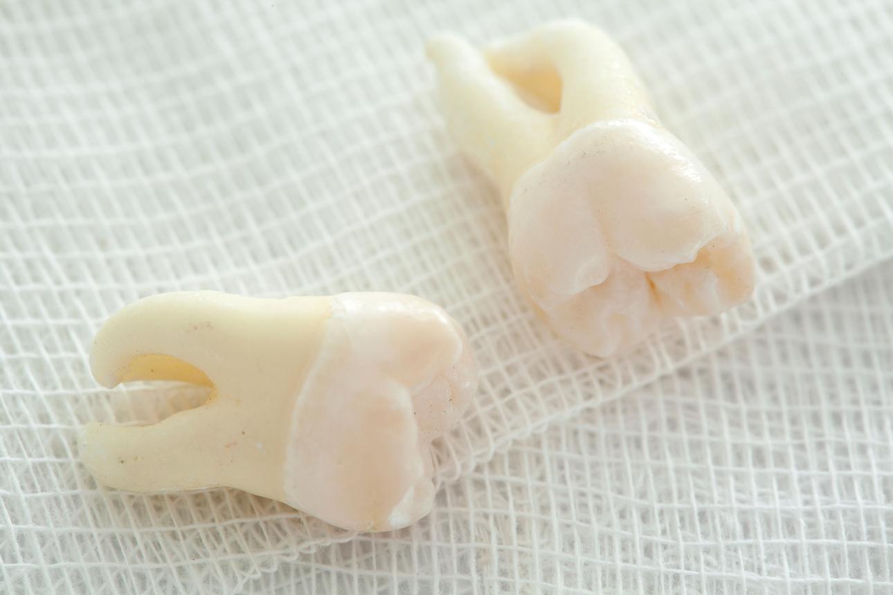 Mơ thấy hai chiếc răng rụng thường được liên hệ với sự lựa chọn, cân bằng trách nhiệm và những thay đổi cùng diễn ra.