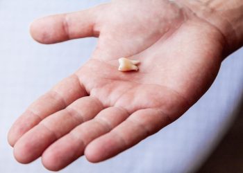 Nằm mơ thấy rụng răng là điềm gì? Hên hay xui, đánh số gì?